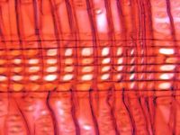 Radial section